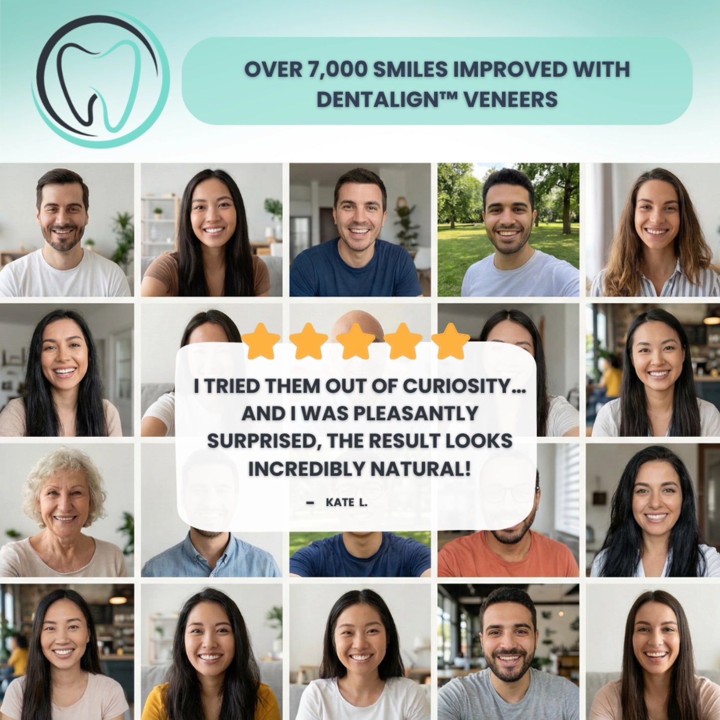 Clip-On Veneers – Dentalign™